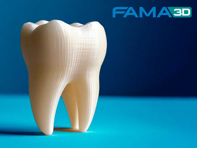Stampa 3D Dentale per Odontoiatria